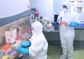 Il Coronavirus è in Veneto: primi due casi a Padova, uno è grave