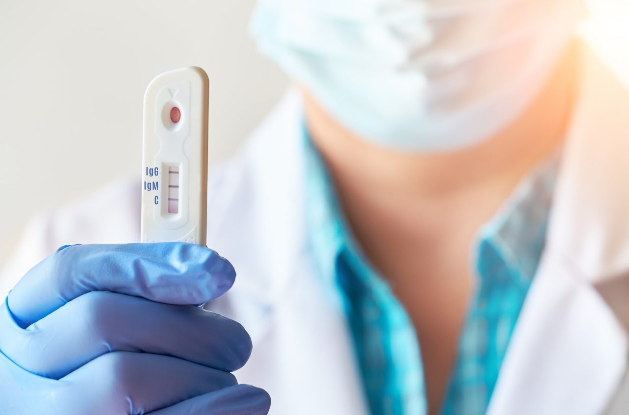 Obbligo tamponi, Zaia precetta anche i veterinari: “L’uomo è un mammifero”