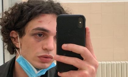 La testimonianza shock del giovane modello vicentino pestato senza pietà dalla baby gang